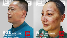 【瑞康战“疫”（四十四）】疫痕：那些镌刻在脸上的美丽故事